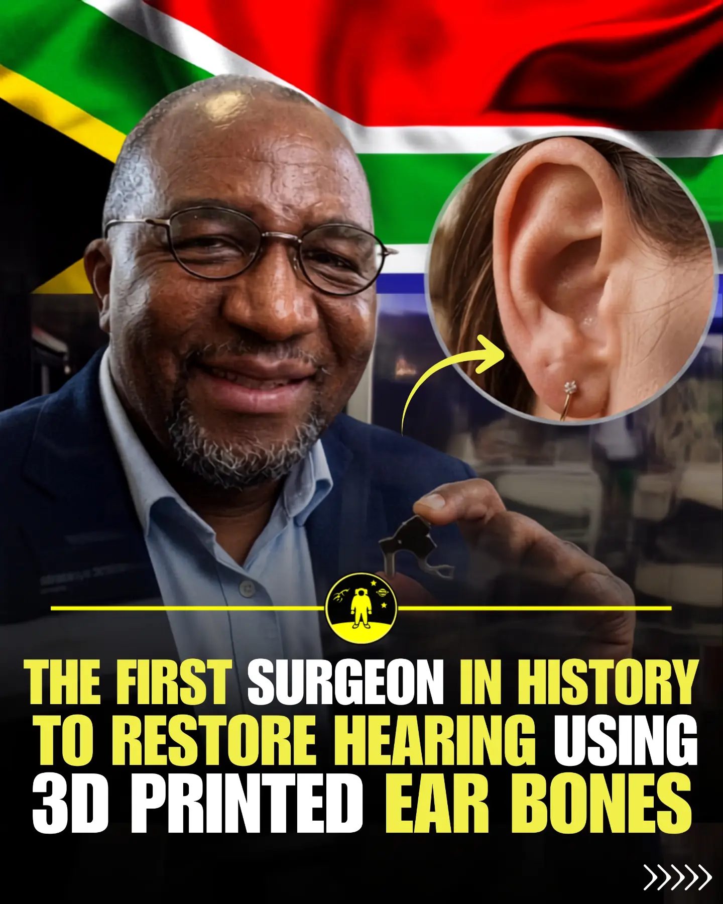 3D Printed Ear Bones Restore Hearing
