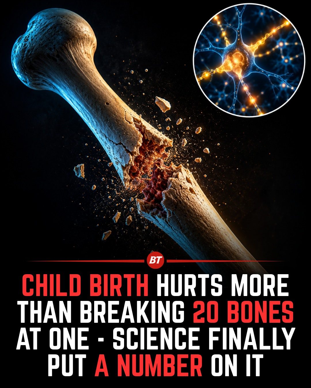 Childbirth Pain vs. Broken Bones: What Science Says