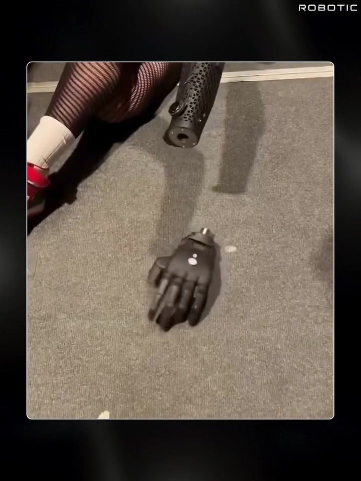 The Hero Arm: First Wireless Bionic Prosthetic