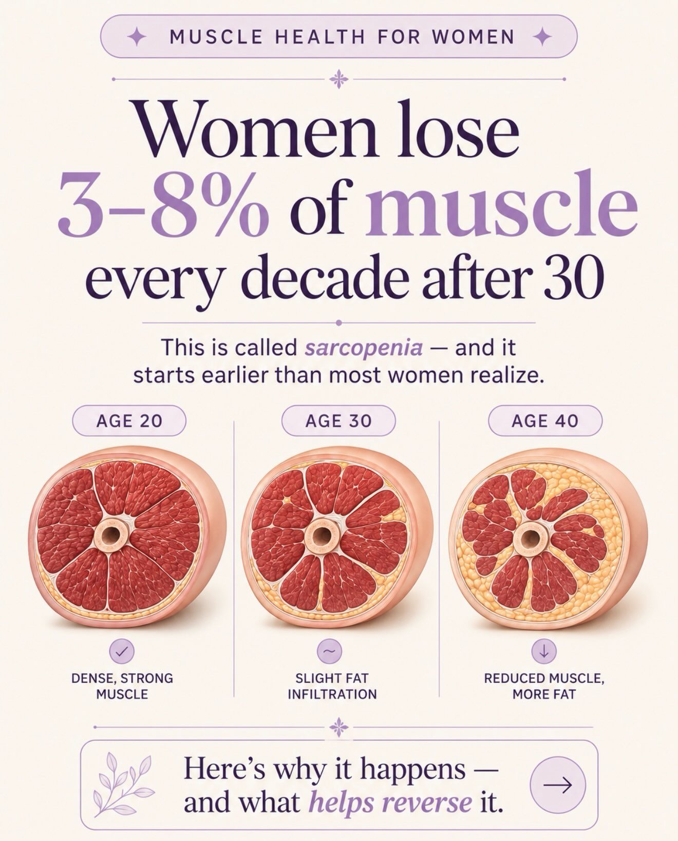 Muscle Loss in Women: Preventing Sarcopenia for Lifelong Health