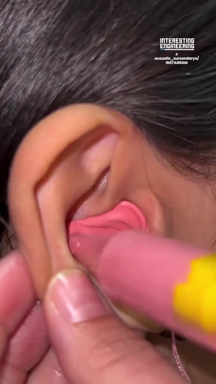 Custom Earplugs: Perfect Fit for Your Ear's Unique Shape