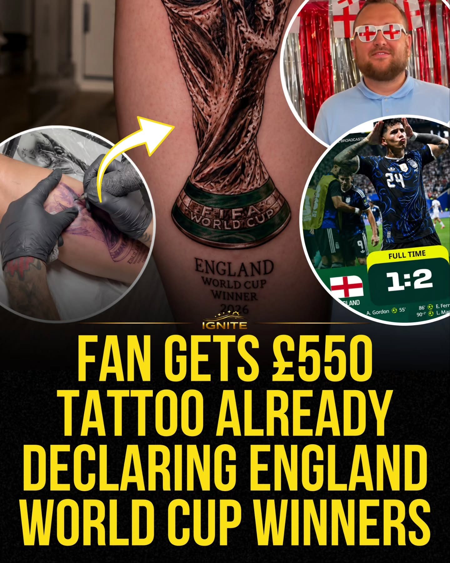 England Fan Bets £550 on World Cup Win with Tattoo
