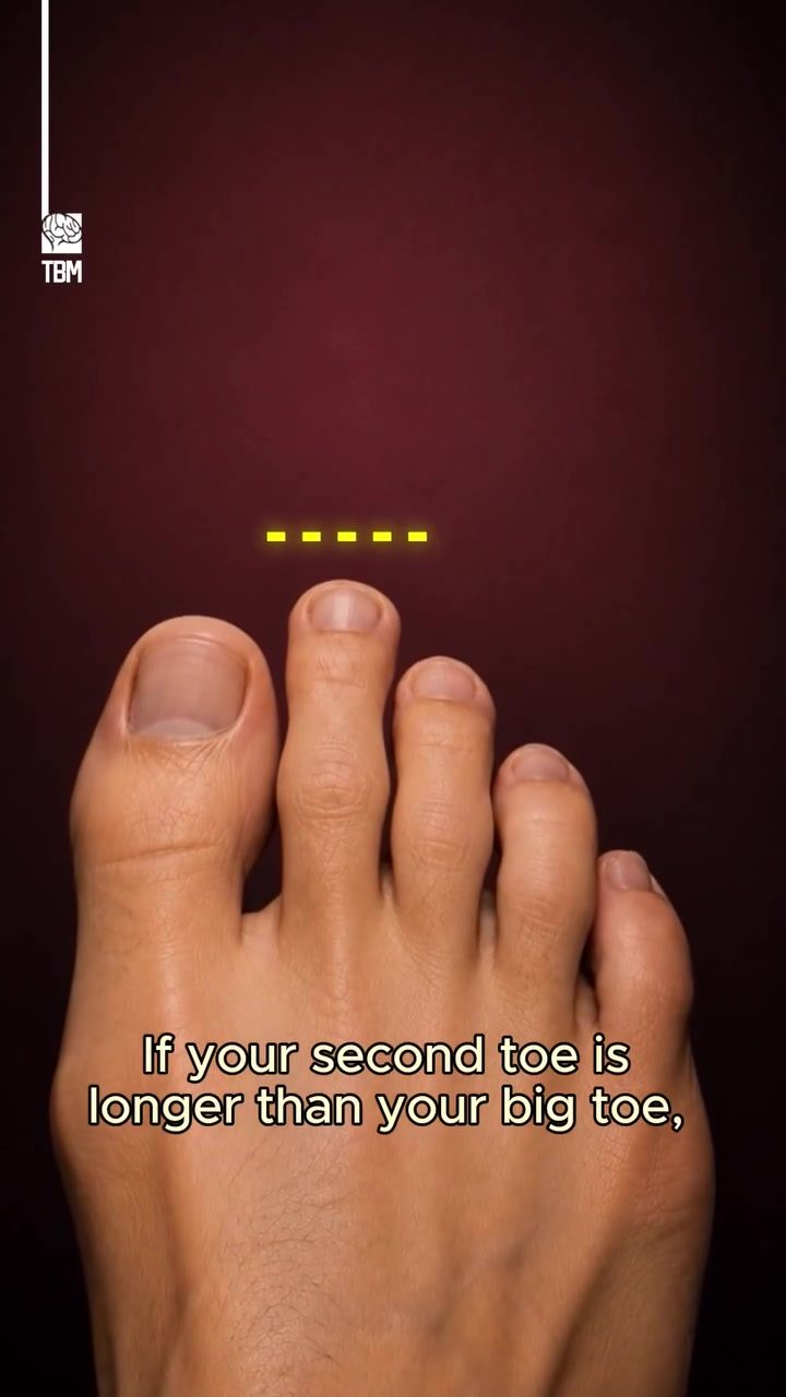 Understanding Foot Types: Egyptian, Greek, and Roman