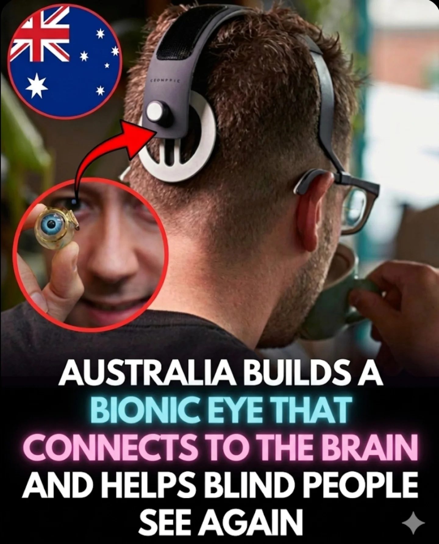 Bionic Eye Breakthroughs From Australia: How Sonopics Helps Blind People See
