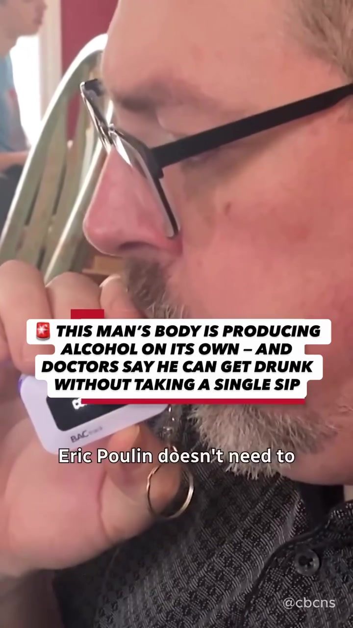 Man's Body Produces Alcohol Without Drinking
