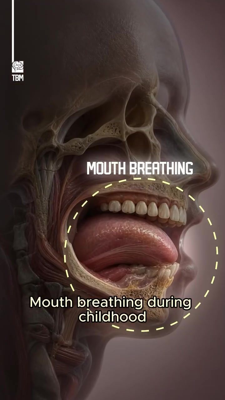 Mouth Breathing's Impact on Jaw and Teeth Development