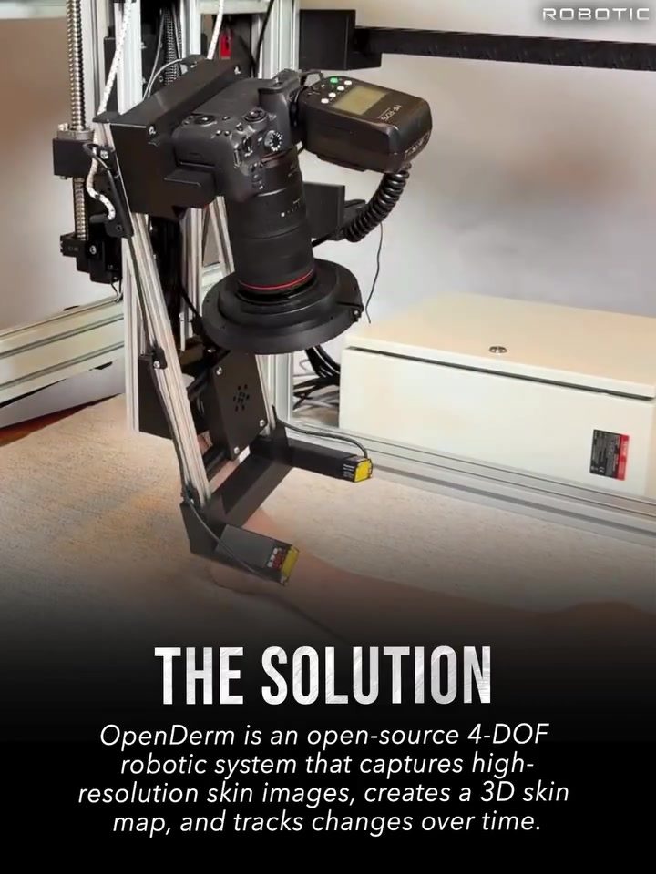 OpenDerm: Enhancing Skin Cancer Detection with 3D Imaging