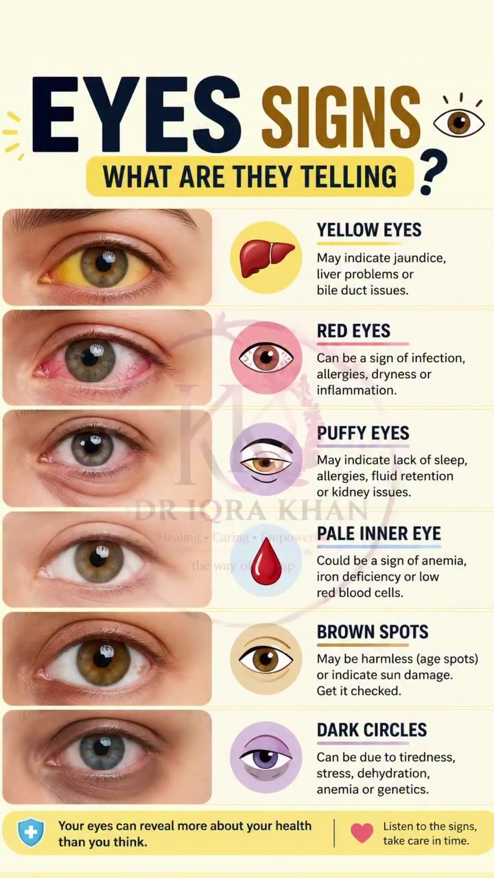Understanding What Your Eye Signs Say About Your Health