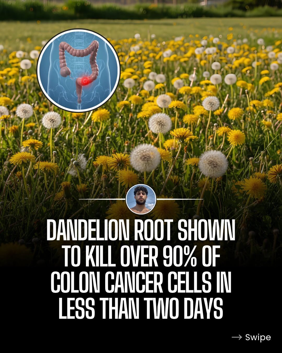 Dandelion Root Extract's Promising Effects on Cancer Cells