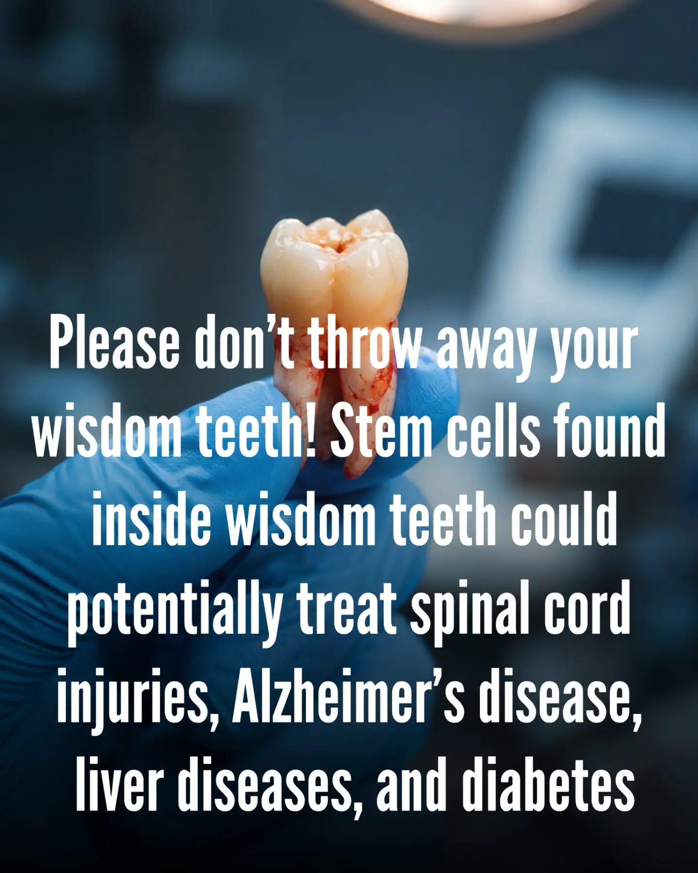 The Power of Wisdom Teeth Stem Cells in Regenerative Medicine