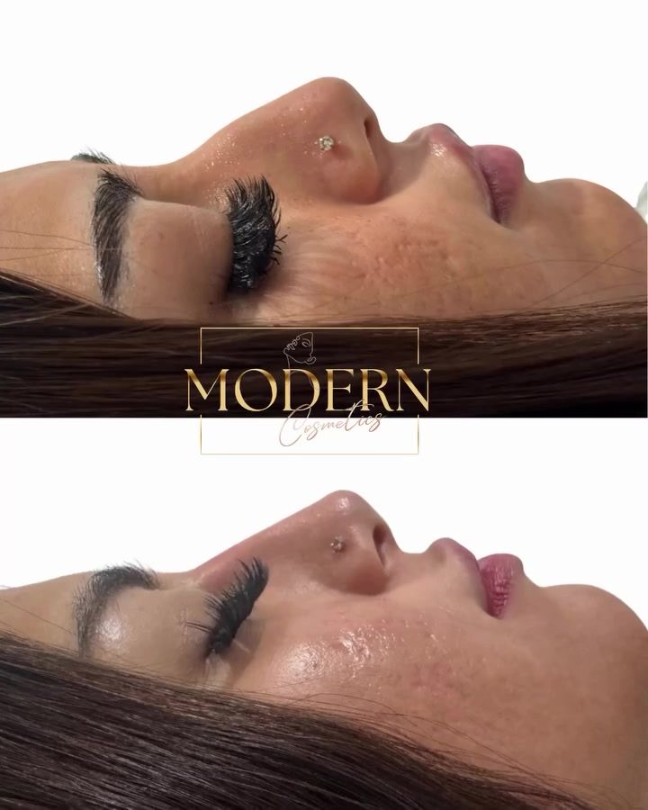 Discover **Modern Cosmetics' Lash Lift Transformation**