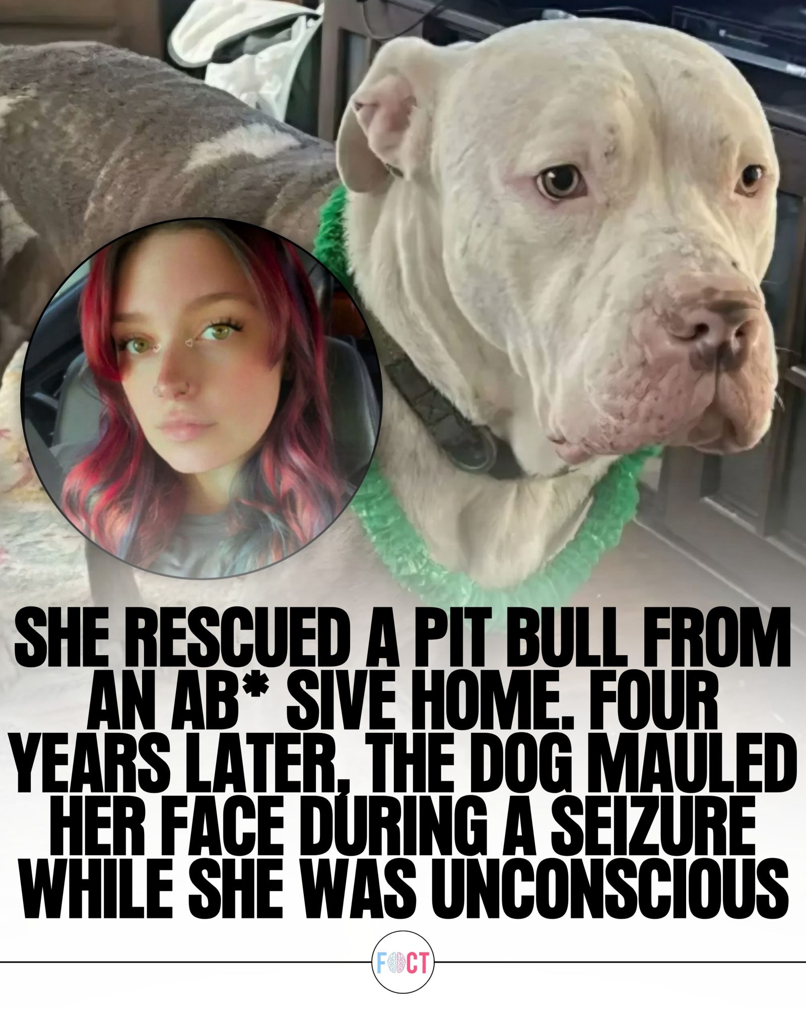 Tragic Dog Attack: Rescue Pit Bull Injures Owner During Seizure