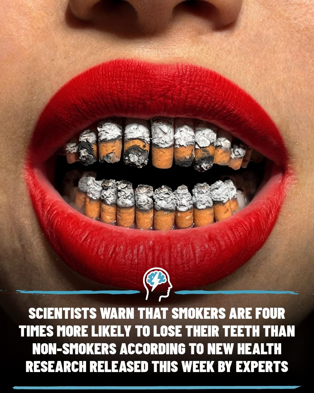 Smoking's Hidden Toll: Four Times Higher Risk of Tooth Loss for Smokers