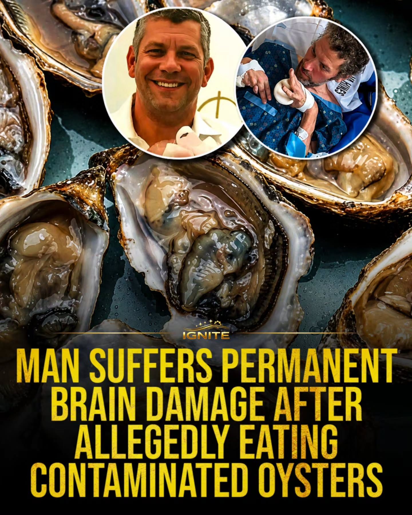 Oyster Consumption Risks: Man's Tragic Case Highlights Dangers