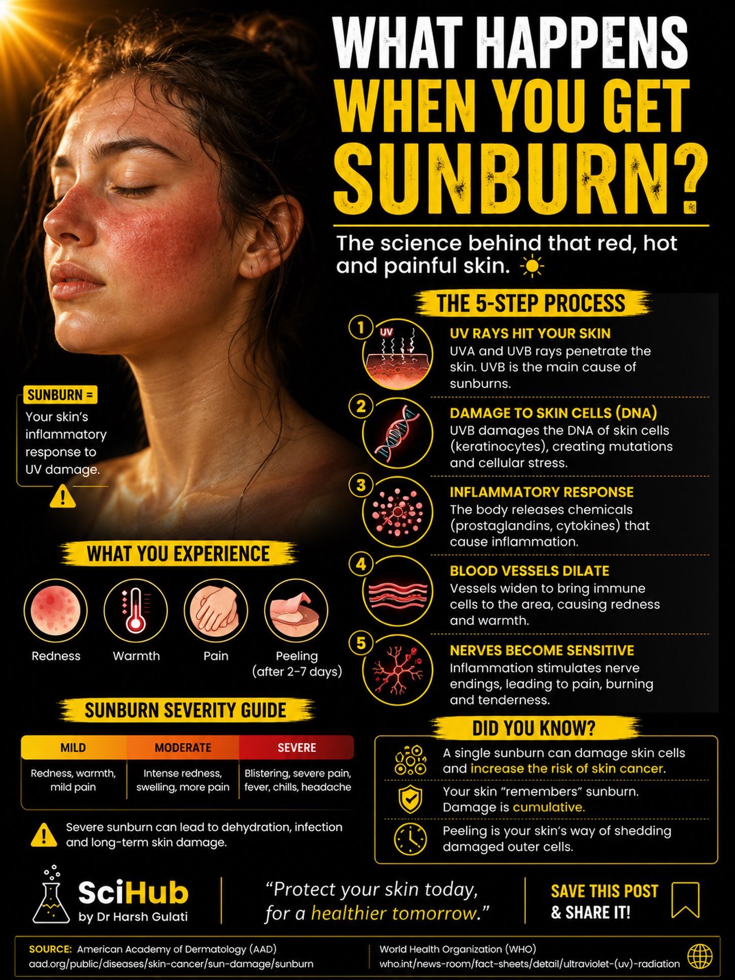 Understanding Sunburn: Causes, Effects, and Prevention