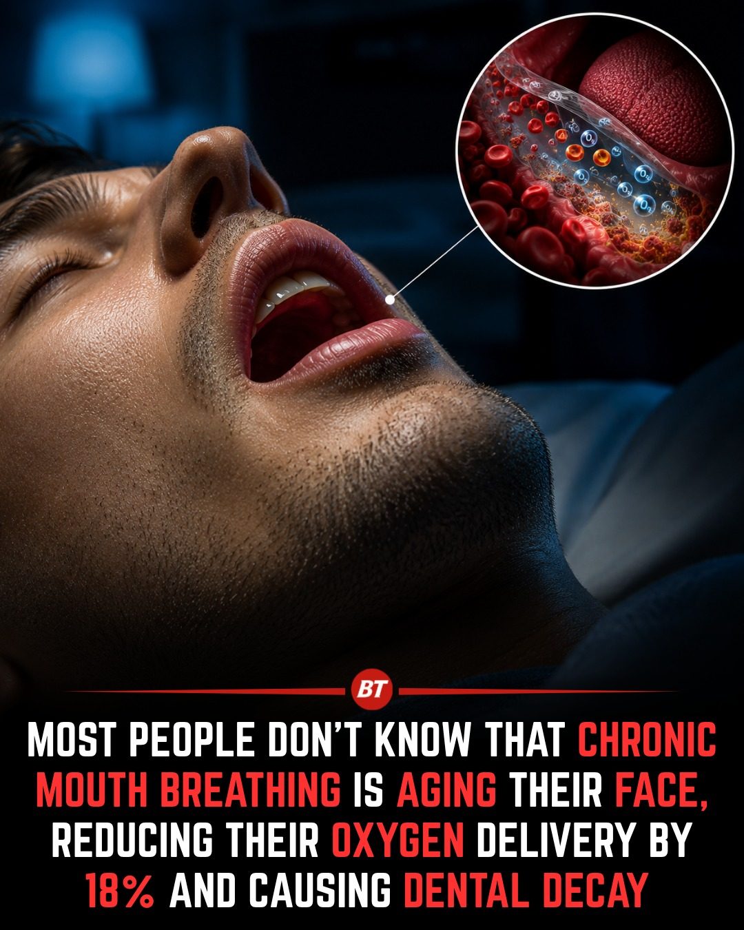 Chronic Mouth Breathing: Effects on Face, Teeth & Health